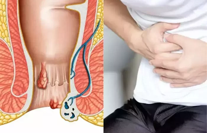 आयुर्वेद डॉक्टर ने बताई खास सब्जी, इसे खाने से हो जाती है Piles समेत पेट की इन बीमारियों की छुट्टी