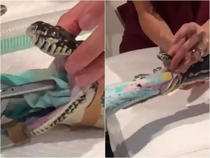 सांप निगल गया था तौलिया, महिला डॉक्टर्स ने मिलकर पहले उसका मुंह खोला, फिर ऐसे निकाला उसे बाहर