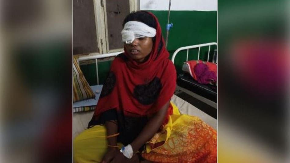 उंगली डालकर निकाल ली पत्नी की आंख, बार-बार मायके जाने से नाराज था पति