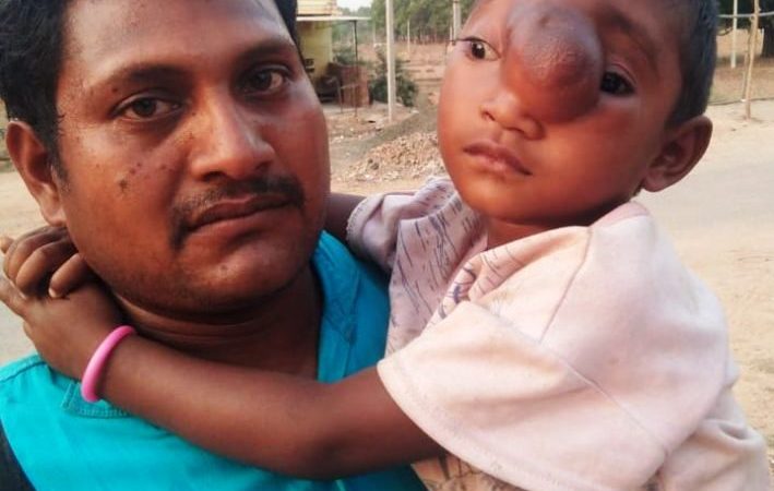 ट्यूमर की बीमारी से पीड़ित चार साल की अदिति का वेल्लोर में होगा इलाज, स्वास्थ्य मंत्री ने दिए निर्देश