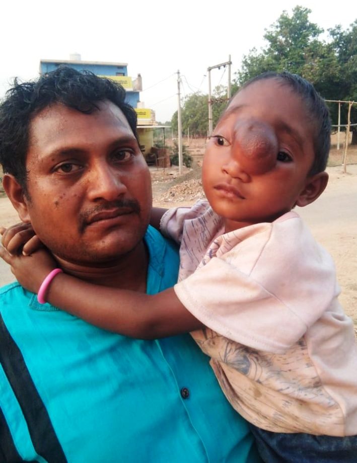 ट्यूमर की बीमारी से पीड़ित चार साल की अदिति का वेल्लोर में होगा इलाज, स्वास्थ्य मंत्री ने दिए निर्देश