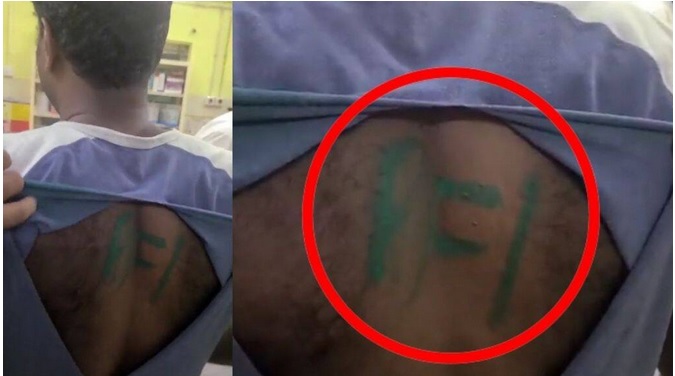सेना के जवान पर हमला, पिटाई कर पीठ पर लिखा ‘पीएफआई’