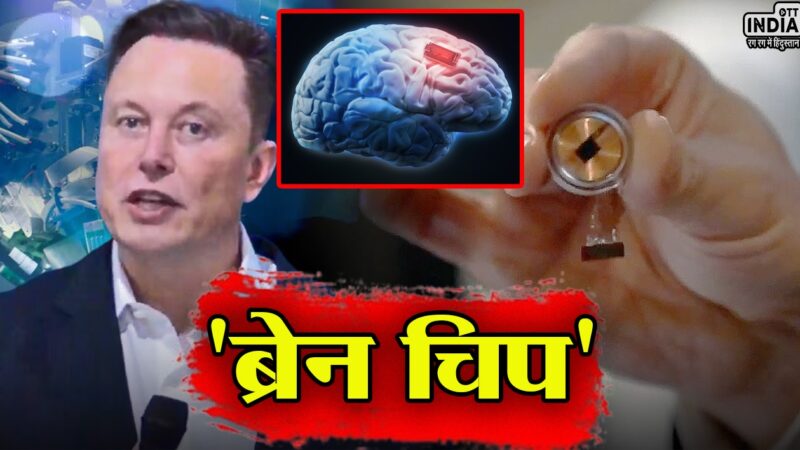 पहली बार इंसानी दिमाग में लगाया गया चिप