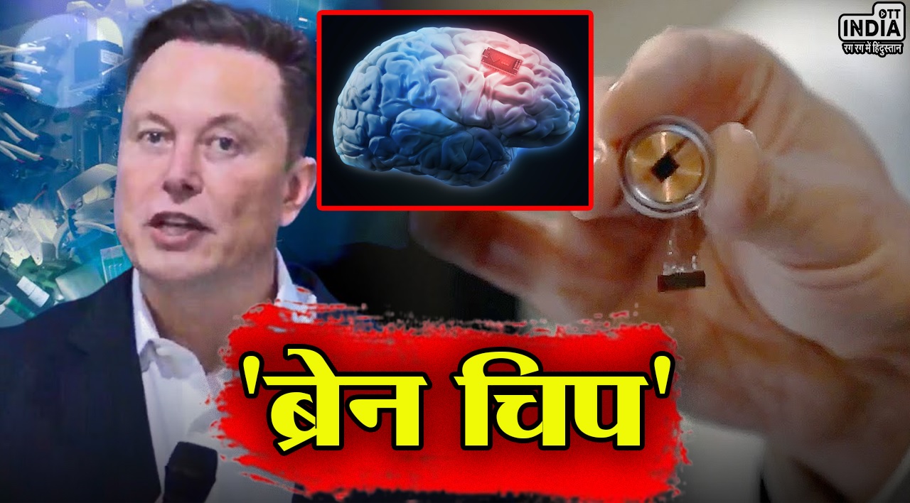 पहली बार इंसानी दिमाग में लगाया गया चिप